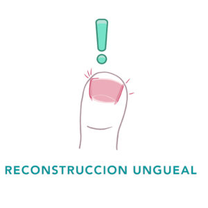 RECONSTRUCCION_UNGUEAL.jpg