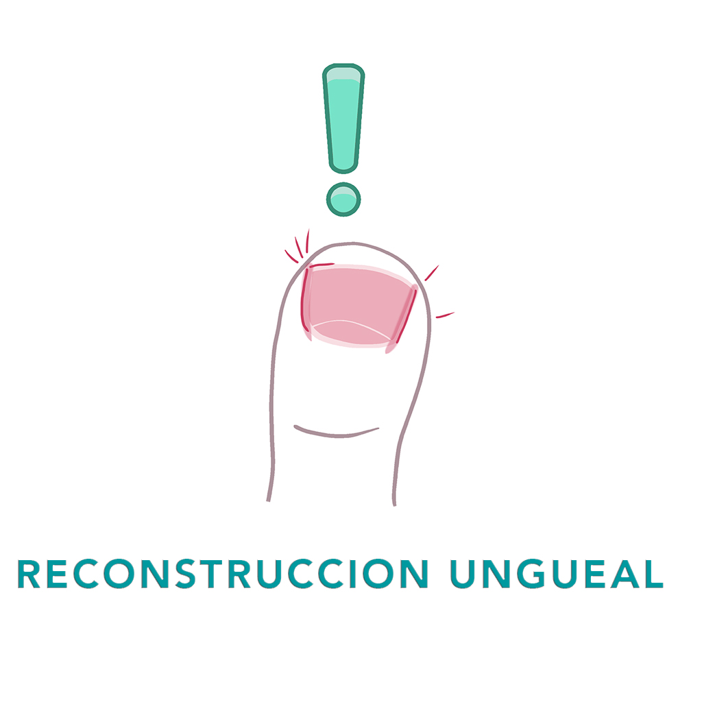 RECONSTRUCCION_UNGUEAL.jpg